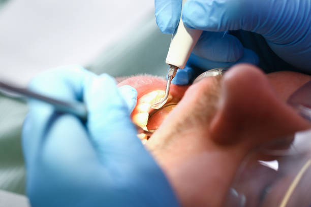 Best Emergency Tooth Extraction  in Coalville, UT